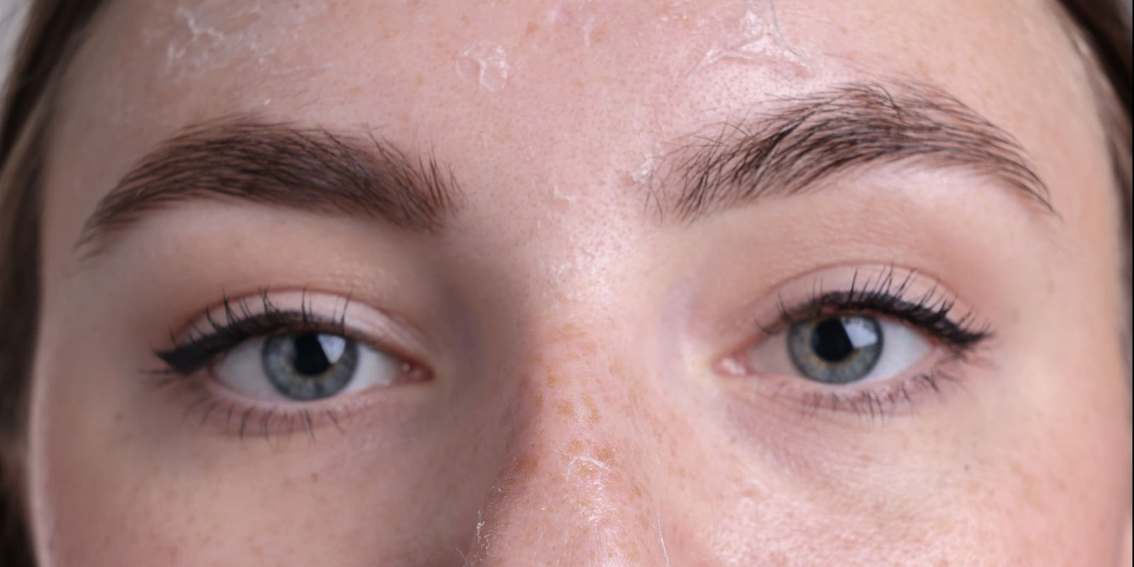 Das Gesicht einer jungen Frau mit trockener Haut