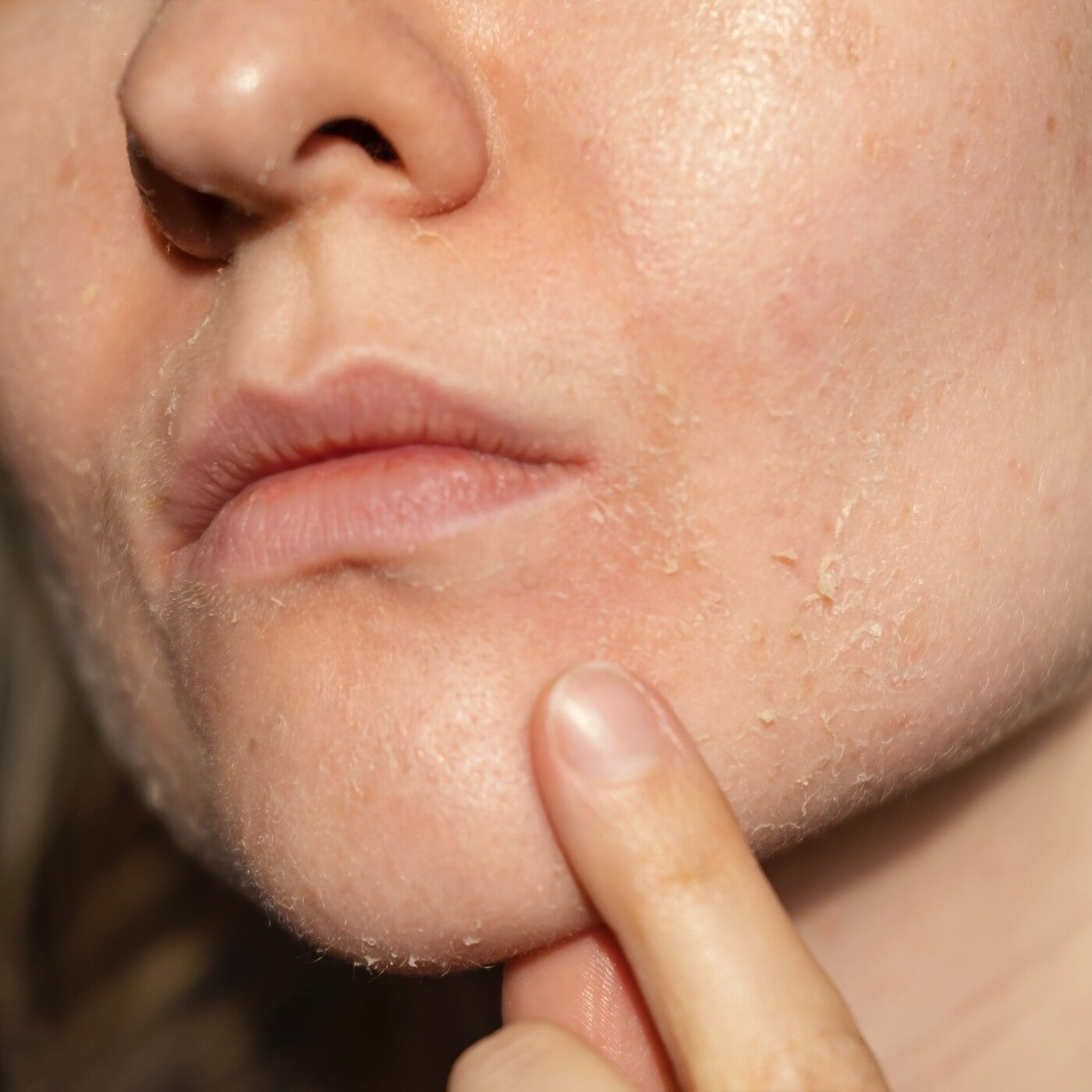 Nahaufnahme einer trockener Wange